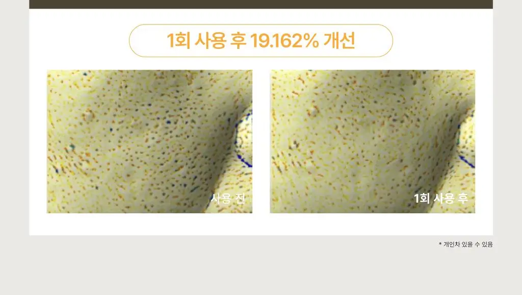[김재원 PICK] 몰바니 율피 포어 타이트닝 세럼 50ml 상세페이지 9